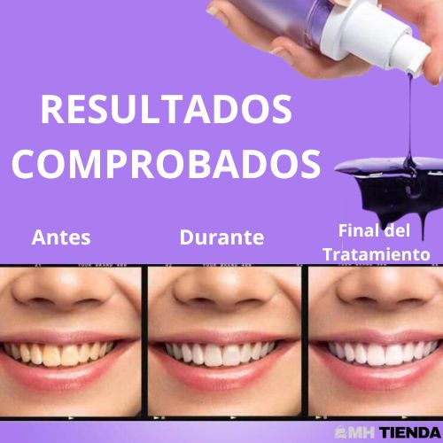 Blanqueador Dental Smile - Dientes Blancos en Segundos - [¡OFERTA COMPRA 1 Y LLÉVATE 2 SOLO HOY!]