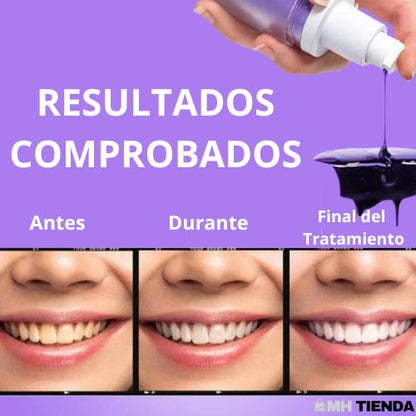 Blanqueador Dental Smile - Dientes Blancos en Segundos - [¡OFERTA COMPRA 1 Y LLÉVATE 2 SOLO HOY!]